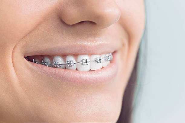 Best Teeth Whitening  in Webb City, MO
